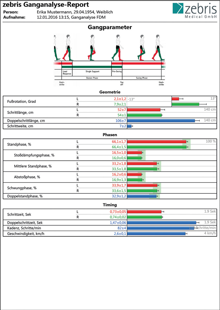 zebris FDM 步态分析报告